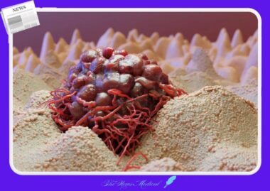 암 그 이름의 기원