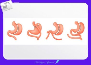 비만 치료의 두 갈래 길