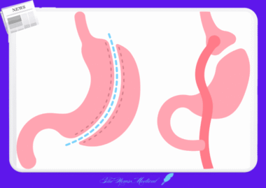 미주신경과 담낭의 연결고리