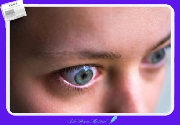 갑상선 그레이브스병 눈 뛰어나옴 안약 의료 눈물 안과 동공 안질환 호르몬