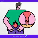 치질, 치루, 항문병, 치핵 대장항문