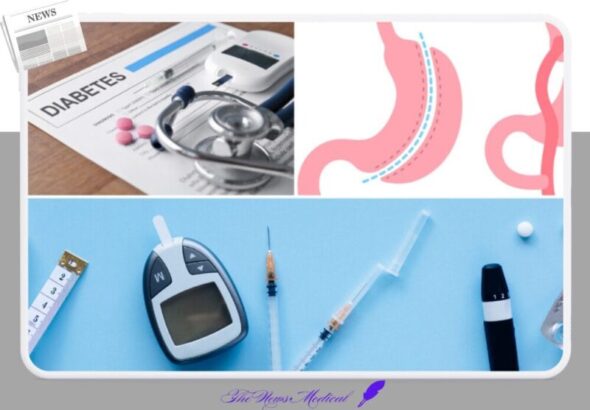 당뇨치료방법 위소매 위절제 비만 약물 청진기 인슐린 혈당체크