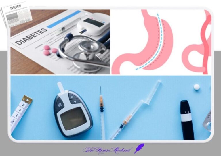 당뇨치료방법 위소매 위절제 비만 약물 청진기 인슐린 혈당체크