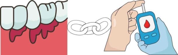 치주질환은 전신 건강을 위협