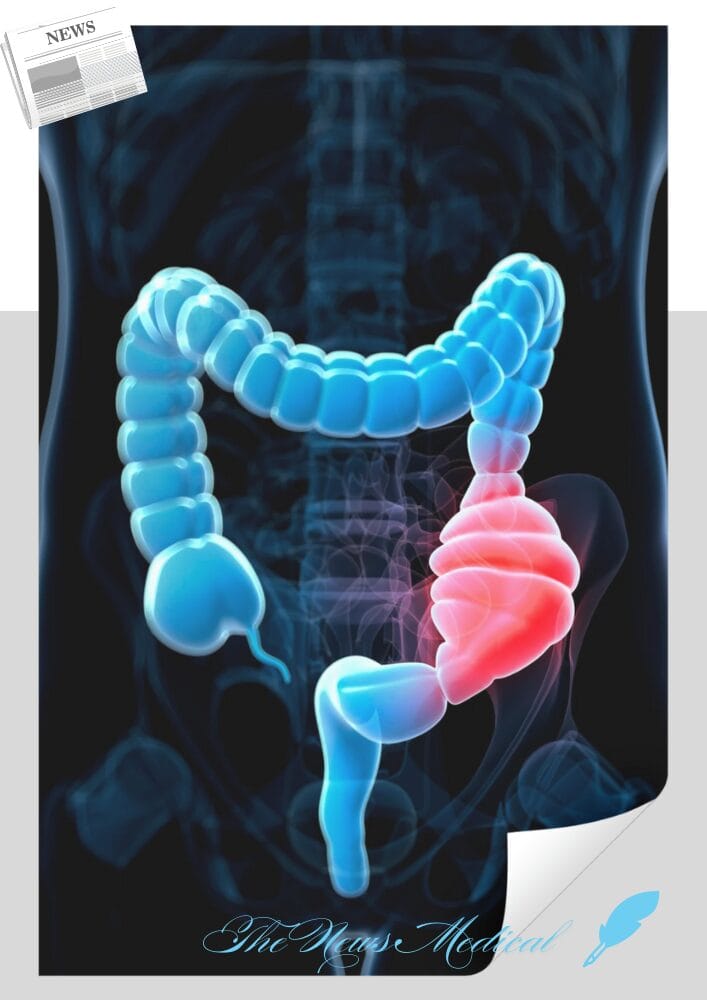 장내 마이크로바이옴