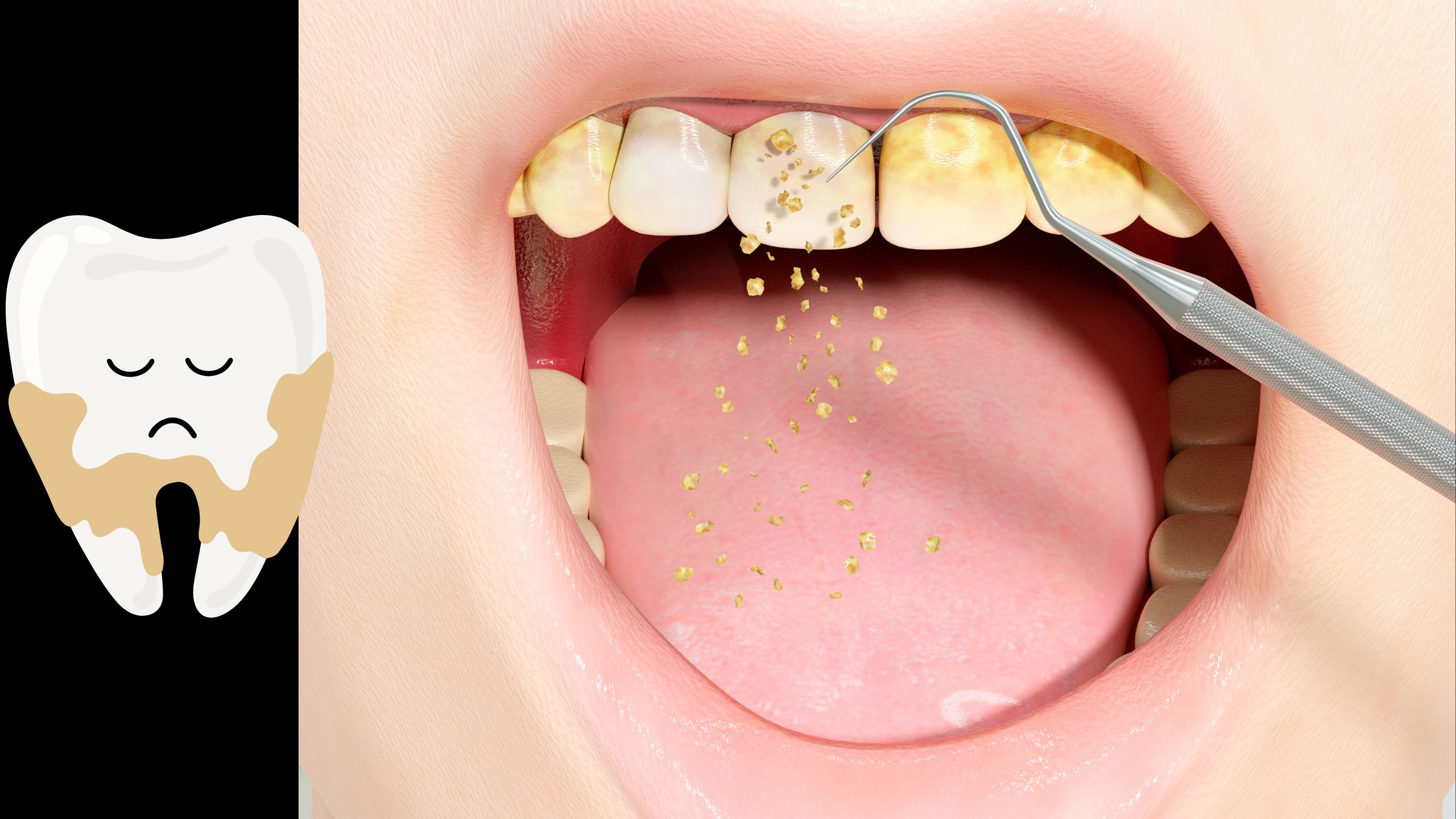 치아만 문제가 아닌 입 냄새