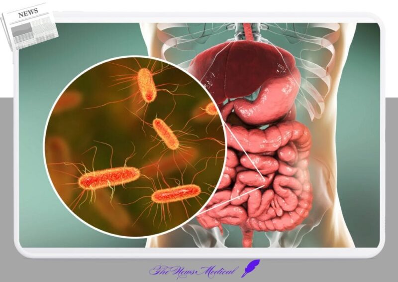 마이크로바이옴 장내세균 대장 소장
