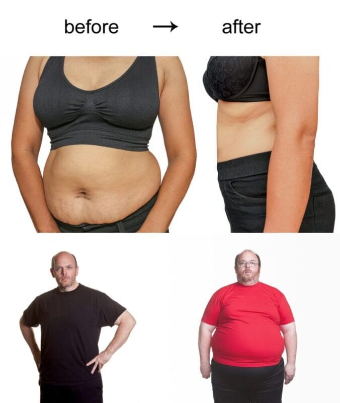 다이어트 내장비만 비포에프터 비만 (2)