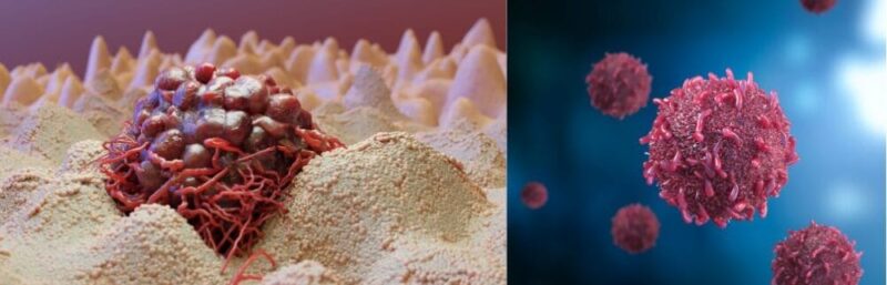 국민배우 안성기 생명 앗아간 혈액암 공포