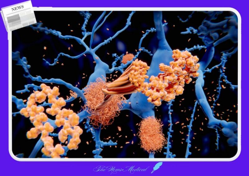 천마 속 가스트로딘