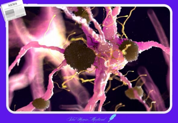 뇌세포, 치매, 알츠하이머