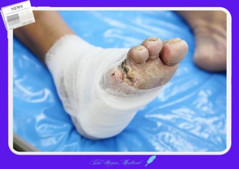 당뇨 족부 당뇨발 당뇨족