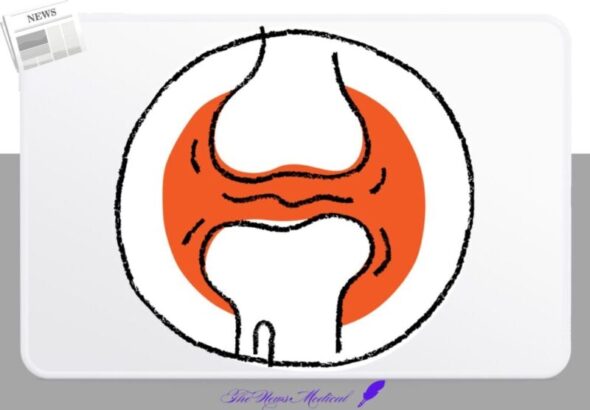 관절 무릎 뼈관절 물렁뼈 연결 연계