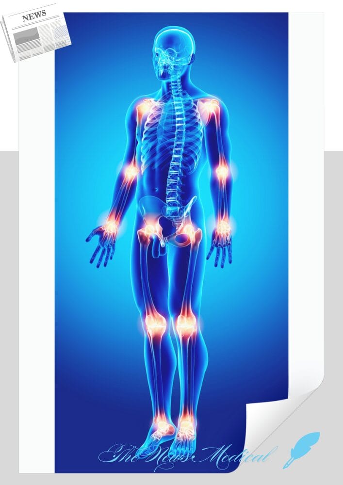 관절의 구조 인체구조 신체 해골