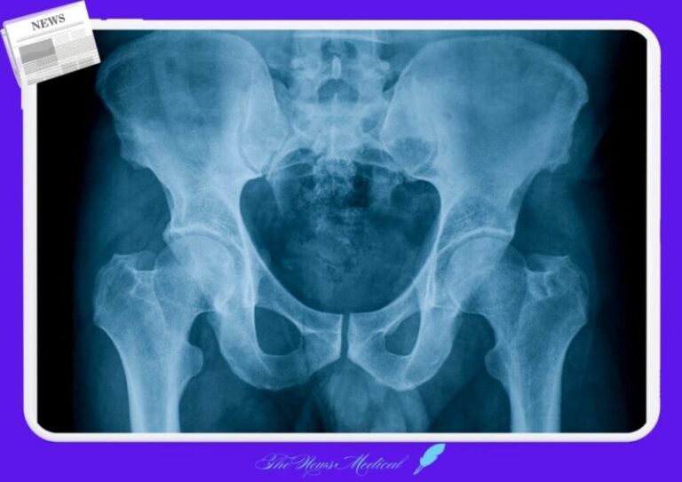 골반남자 엑스레이 방사선