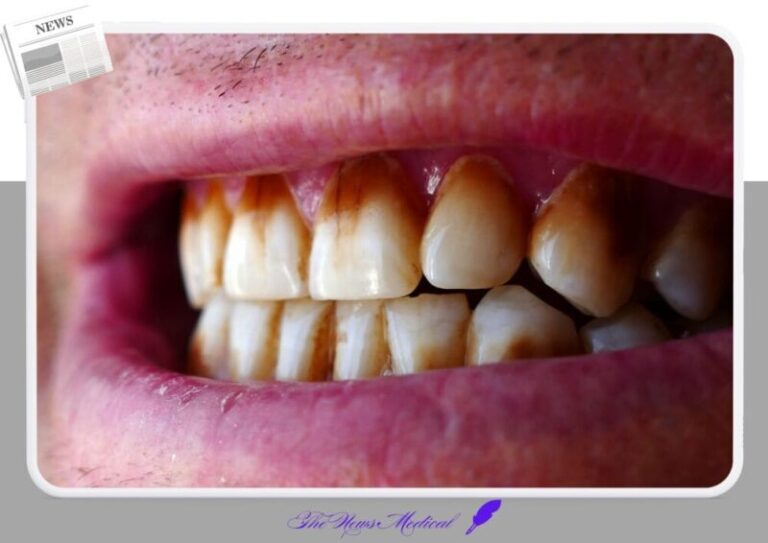 치아불균형 머지얼 드리프트 치석 치과 잇몸 치주염 입술 이닦기 치약 치솔