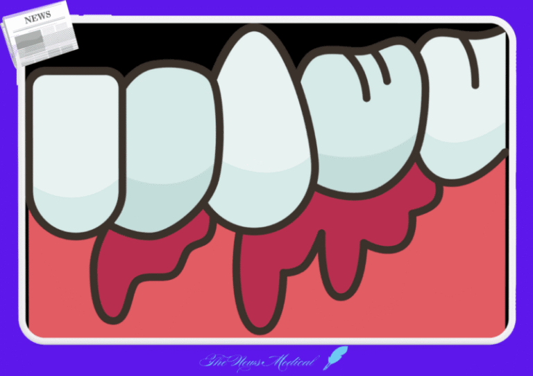 치통 치아 통증