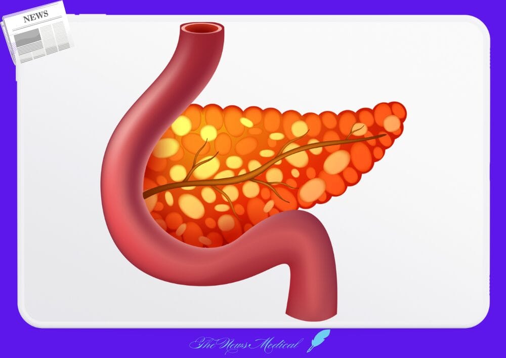 당뇨병의 두 얼굴