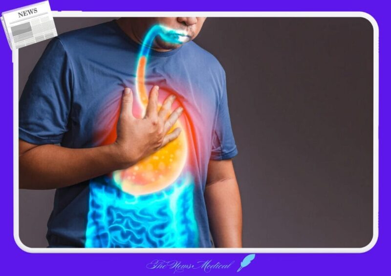 가슴 위장 위염 위통증 위산 속쓰림 식도염