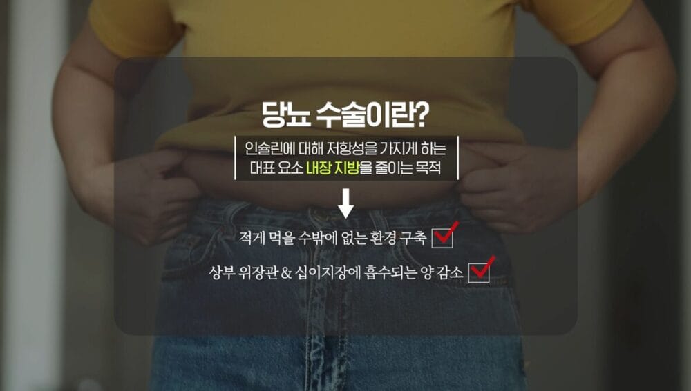 위소매절제술 당뇨