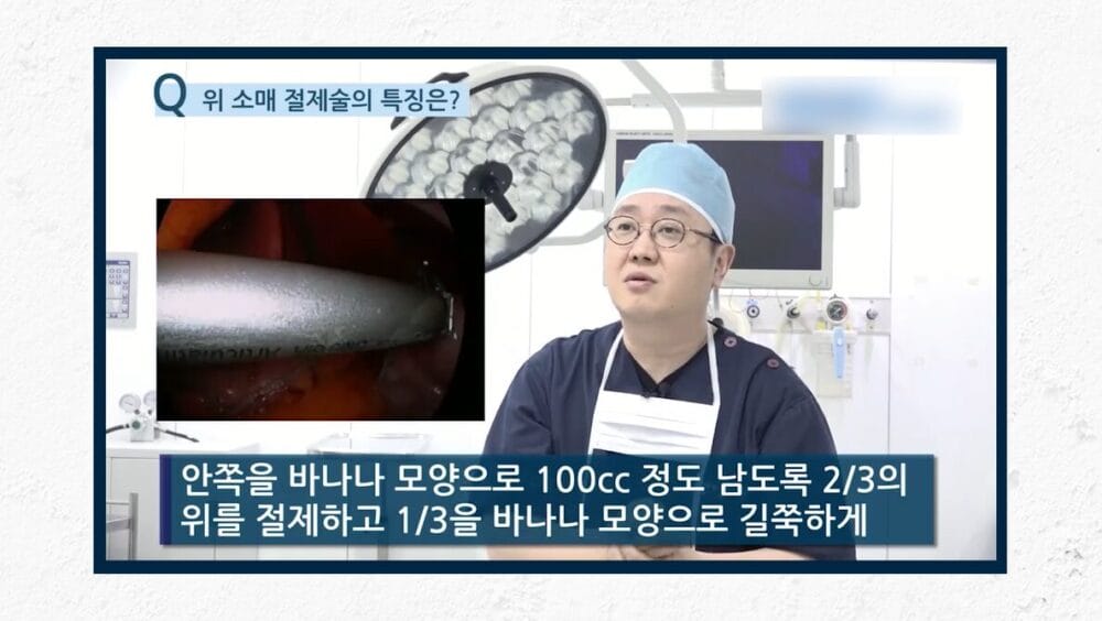 위소매절제술 당뇨