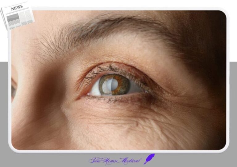 백내장 안과 안구 눈병 수술 동공 눈주름 눈동자