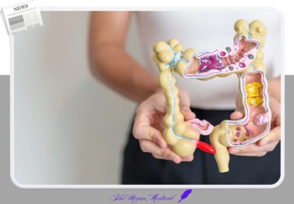 맹장염 급성충수염 대장