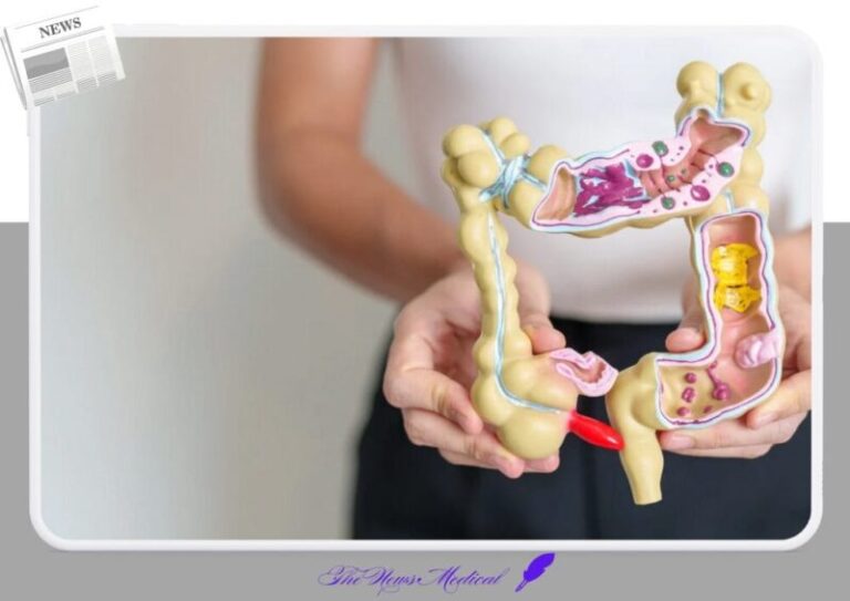맹장염 급성충수염 대장