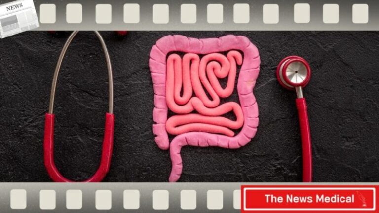 대장, 직장 진료 탈장 소장 과민성