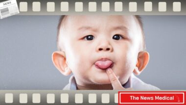 목에 있어야 할 갑상선이 혀 밑에