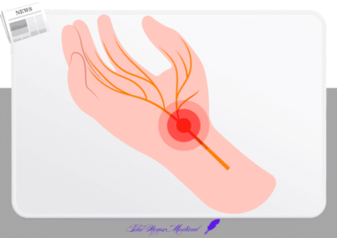 스마트폰이 망친 손가락 건강