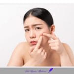 여드름 피부 청소년 청춘 짜다 짜내다