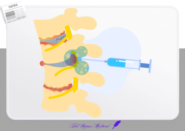 2026년도 선별집중심사 대상항목