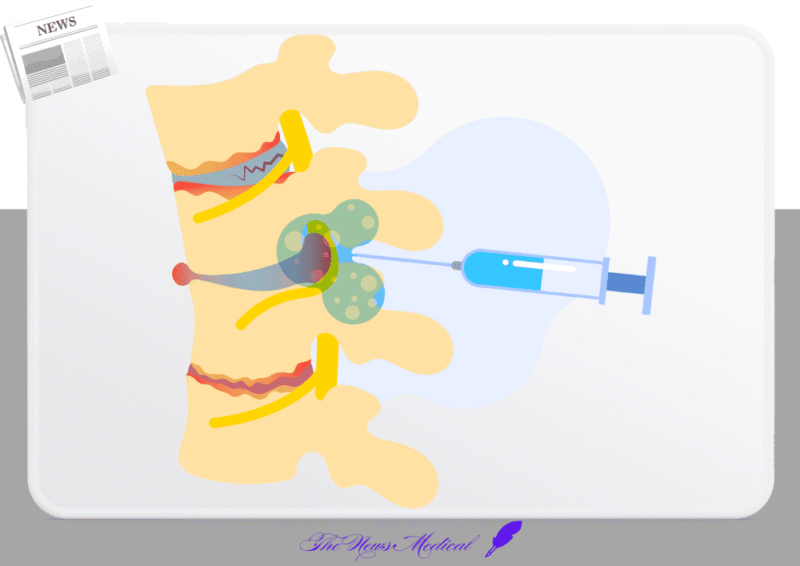 2026년도 선별집중심사 대상항목