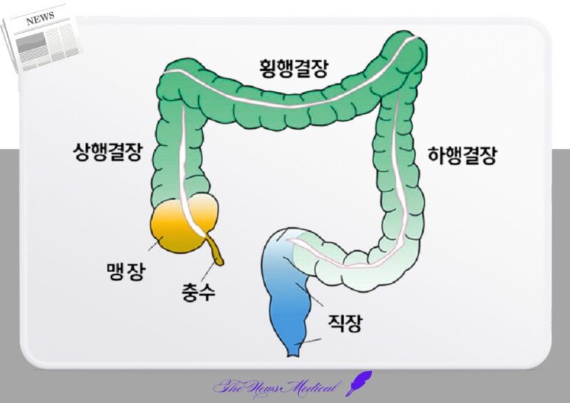 대장 결장 맹장 충수 직장