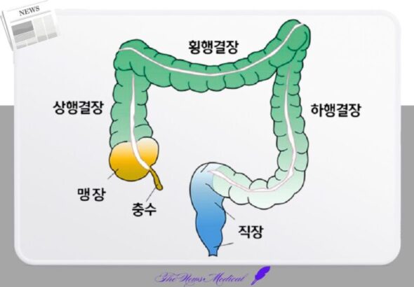 대장 결장 맹장 충수 직장