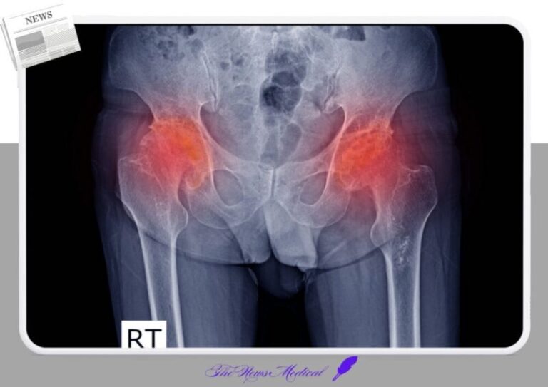 고관절 괴사 엑스레이 검사