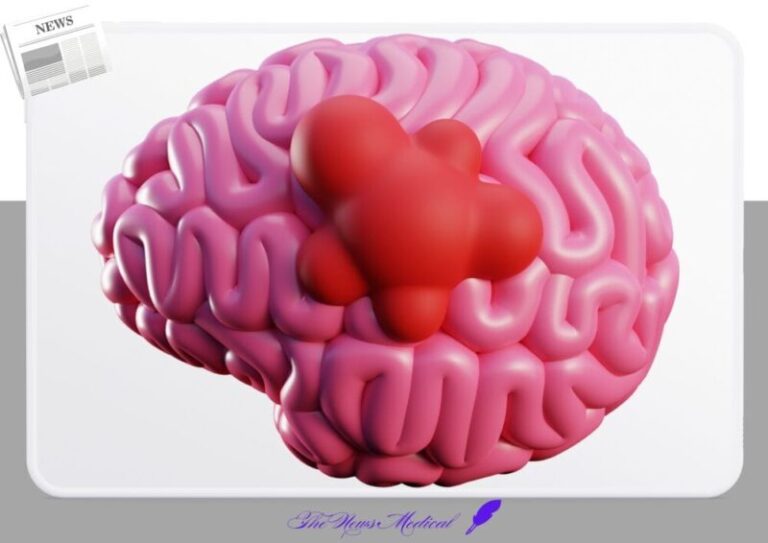 뇌종양 악성종양