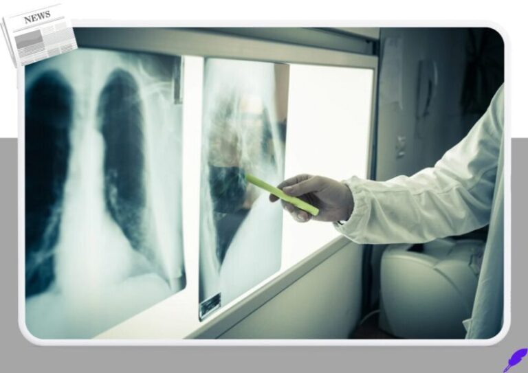 건강검진 엑스레이