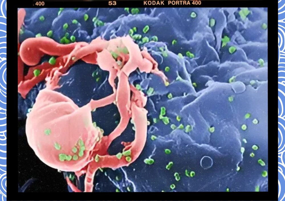 필리핀 HIV 감염 아시아 태평양 지역 확산 주도