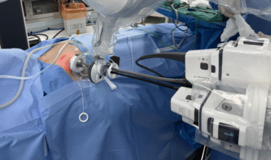 목선 지키는 갑상선암 수술