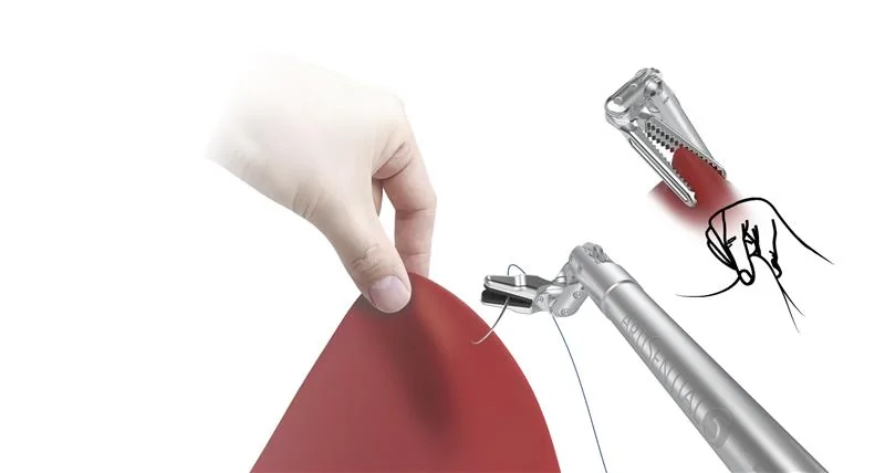 아티센셜 복강경과 다빈치 Xi 로봇 시스템 전격 비교
