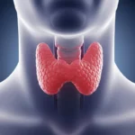 갑상선암 수술 후 요오드 치료 정말 필수