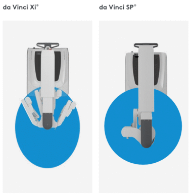 갑상선암 다빈치 로봇수술 Xi와 SP 전격 비교