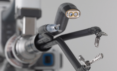 다빈치SP 로봇 수술