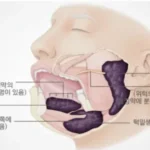침샘, 얼굴옆선