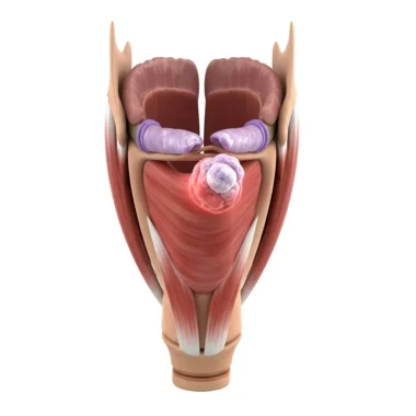 흡연이 부르는 후두암