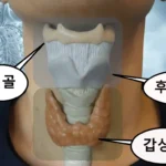 설골, 갑상선, 후두돌기, 성대