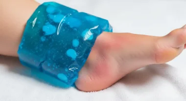 냉찜질이 무조건 좋다