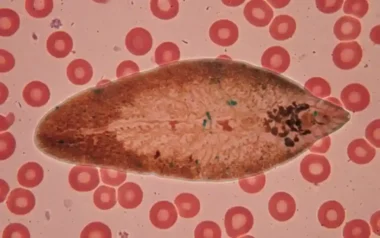민물고기 생식 습관이 부른 담관암